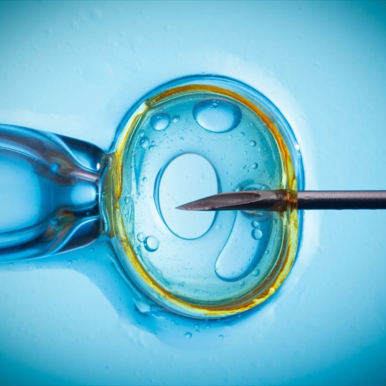 A Step-by-Step Overview of the IVF Treatment Process