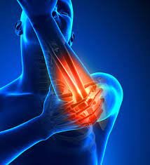 Causes of Elbow Pain: A Complete Guide