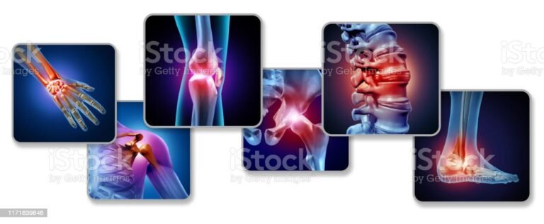 Knee Pain: Investigating Non-Injury Causes